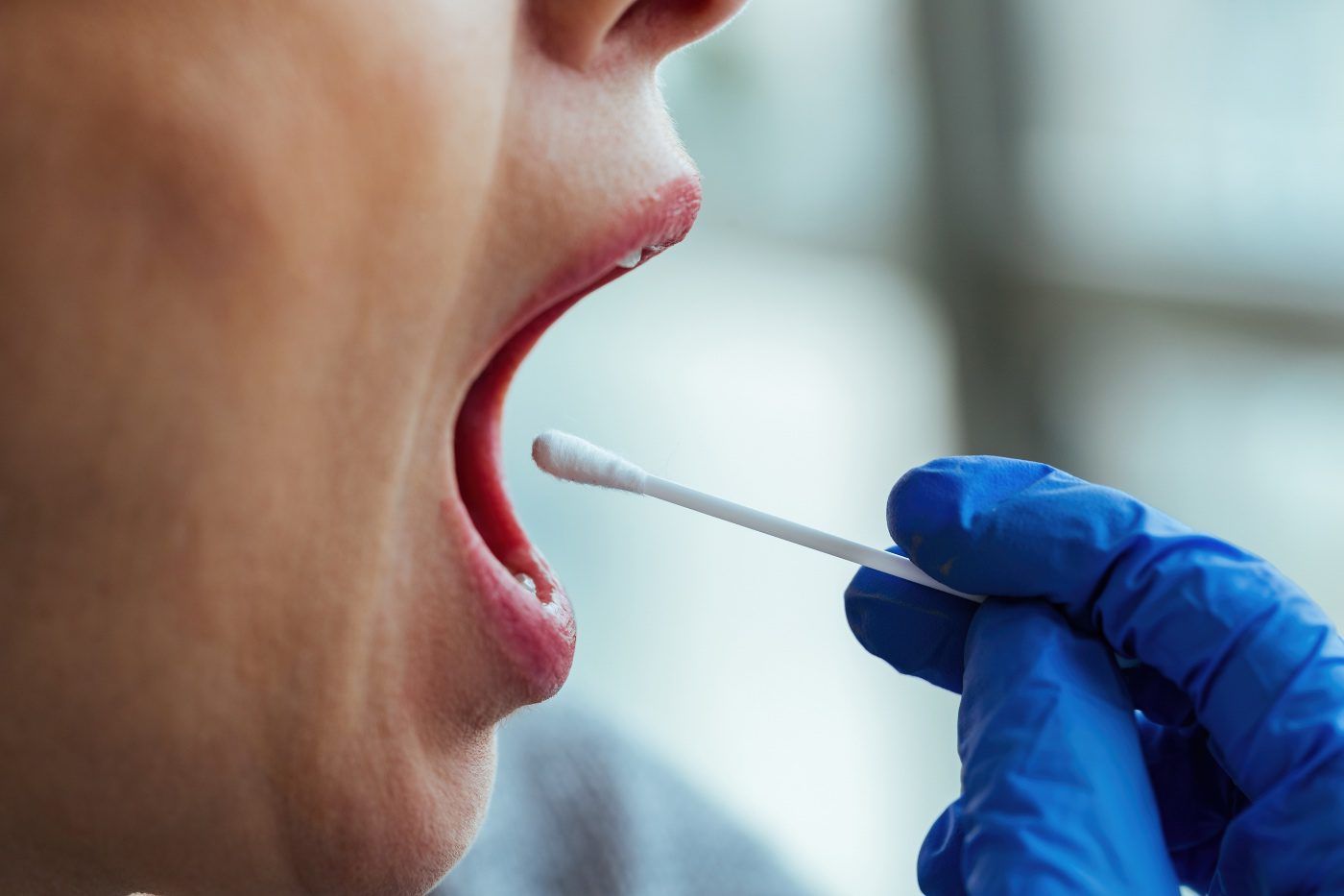 Uso cigarrillos electrónicos muestra variaciones microbiota oral